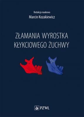 Złamania wyrostka kłykciowego żuchwy - Marcin Kozakiewicz 