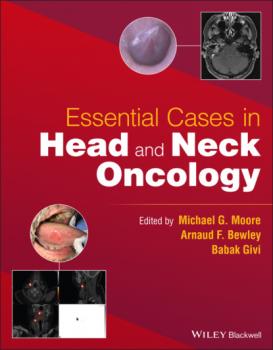 Essential Cases in Head and Neck Oncology - Группа авторов 