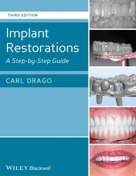 Implant Restorations. A Step-by-Step Guide - Carl  Drago 