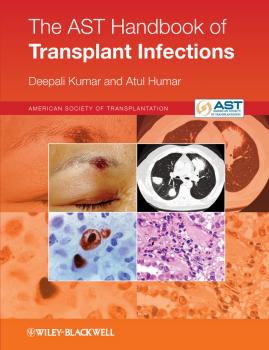 The AST Handbook of Transplant Infections - Humar Atul 