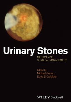 Urinary Stones. Medical and Surgical Management - Grasso Michael 