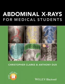 Abdominal X-rays for Medical Students - Christopher  Clarke 