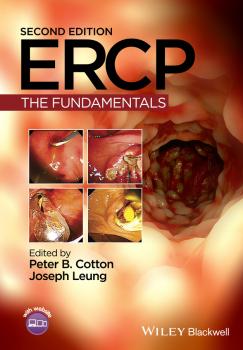 ERCP, Enhanced Edition. The Fundamentals - Peter Cotton B. 