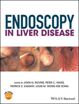 Endoscopy in Liver Disease - Louis-Michel Wong Kee Song 
