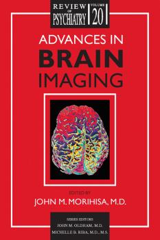 Advances in Brain Imaging - Отсутствует 