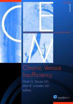 Chronic Venous Insufficiency - Отсутствует Contemporary Endovascular Management