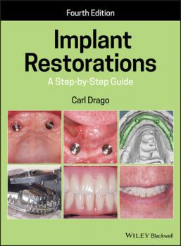 Implant Restorations - Carl  Drago 