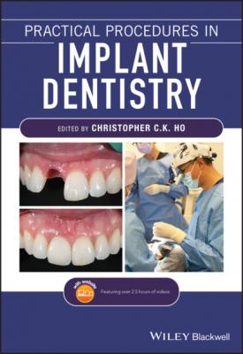 Practical Procedures in Implant Dentistry - Группа авторов 