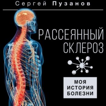 Рассеянный склероз. Моя история болезни - Сергей Пузанов Здоровье Рунета